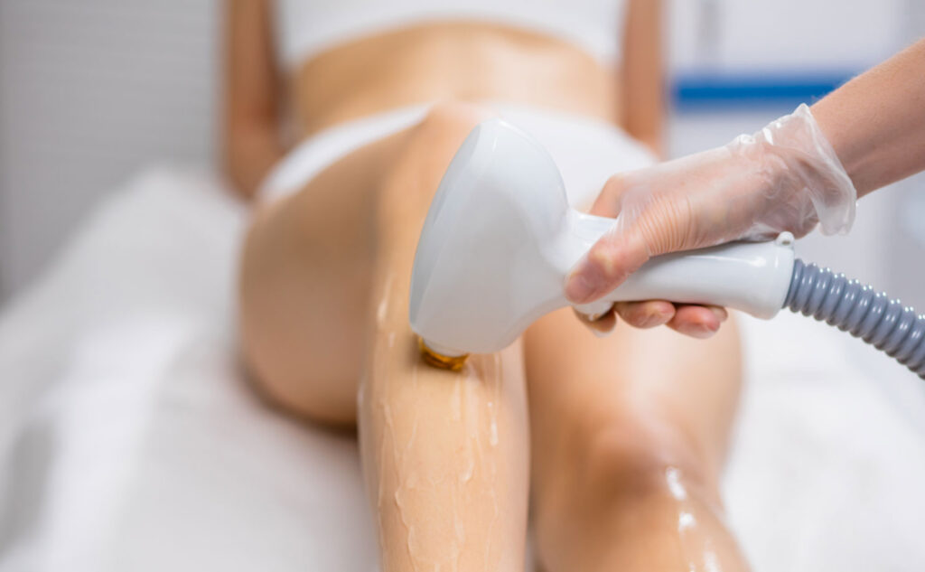Laser Vein Treatment