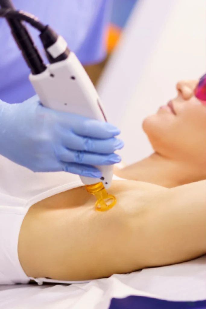 LAser Hair Removal